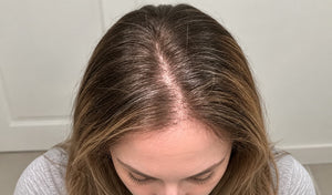 Hair that's lost its fullness